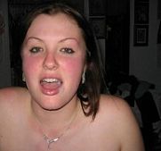 hot facial tip