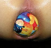 jaw breaker fist hot gay super fist fisting injuries